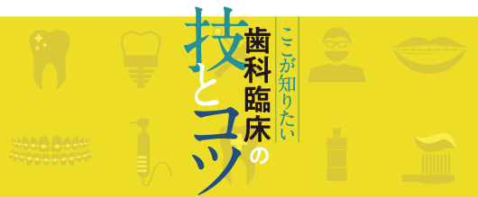 ここが知りたい 歯科臨床の技とコツ