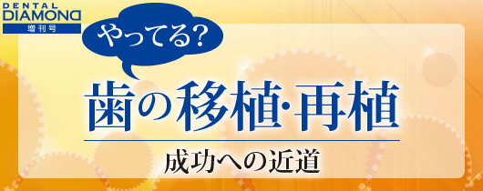 やってる？　歯の移植・再植