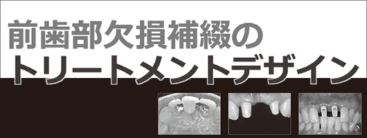 前歯部欠損補綴のトリートメントデザイン