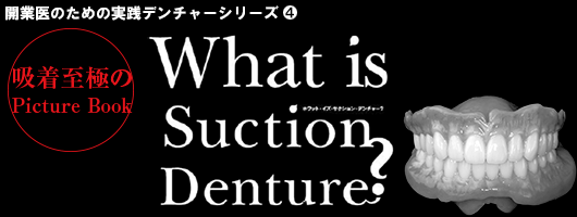 【開業医のための実践デンチャーシリーズ】What is Suction Denture？