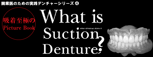 【開業医のための実践デンチャーシリーズ】What is Suction Denture?