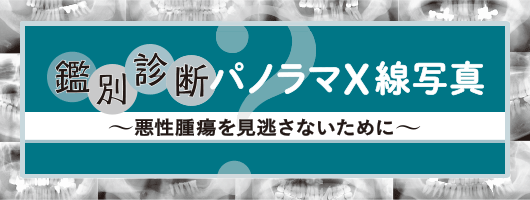 鑑別診断 パノラマX線写真 ～悪性腫瘍を見逃さないために～