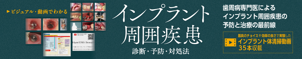 【6月の新刊】インプラント周囲疾患　診断・予防・対処法